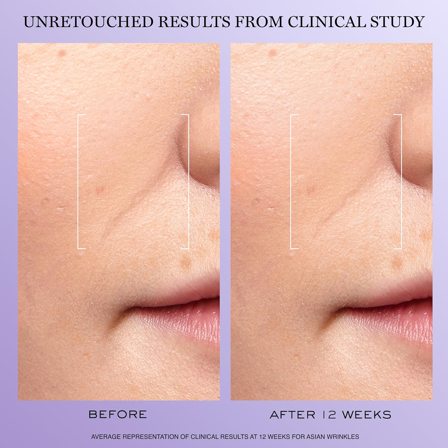 Lancôme Rénergie H.C.F. Triple Serum